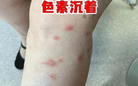 梅花和腊梅能吃吗？药用价值与安全指南
