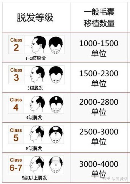 毛发移植一般需要多少钱? 毛发移植价格因素汇总表