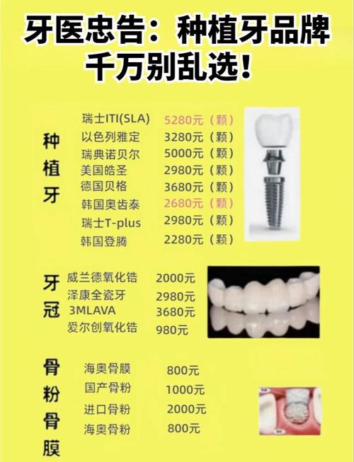 干燥症能种牙吗?全面评估与种植指南 结论