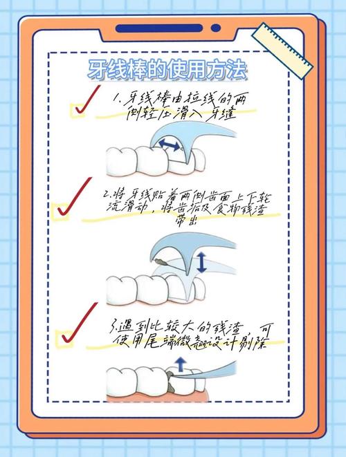 种牙的线是可消化的么?——园艺绑扎线材的环保选择指南 四、使用注意事项