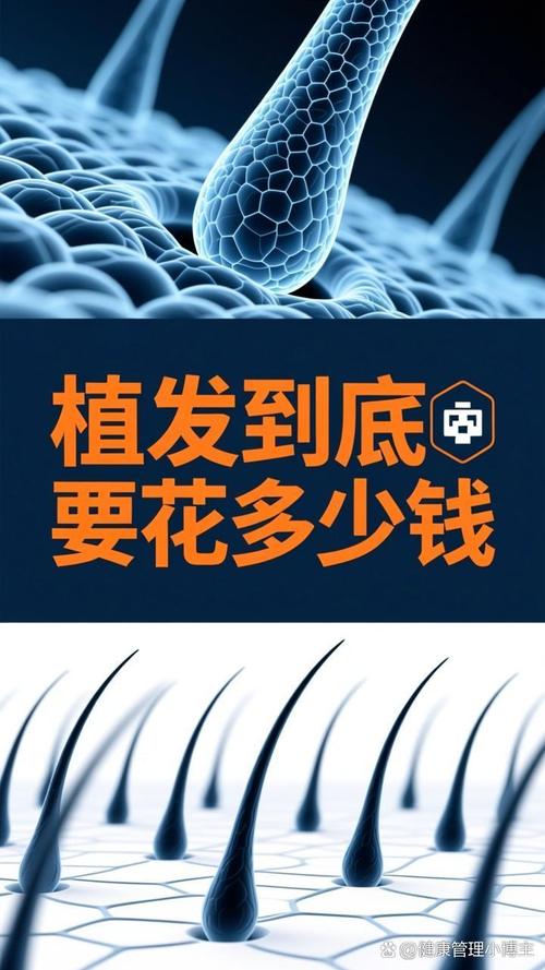 一般毛发种植手术要多少钱?一份详细的价格参考指南 规格因素:种植毛囊单位数量是核心
