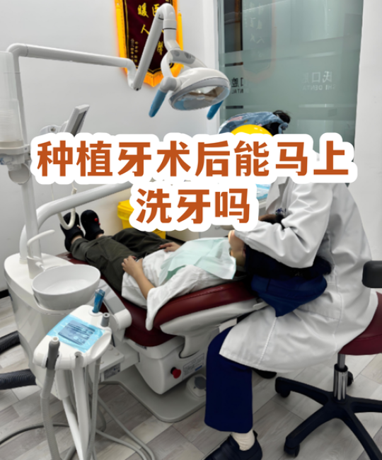 种完牙能洗澡吗？——园艺种植后浇水的正确方法