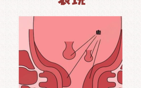 菊花肿了一瓣怎么回事？别慌，3个原因+对症修复方案