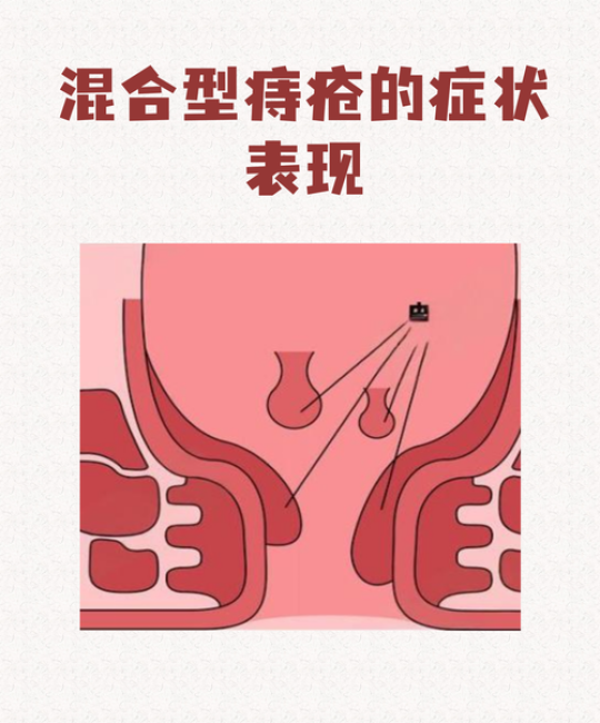菊花肿了一瓣怎么回事？别慌，3个原因+对症修复方案