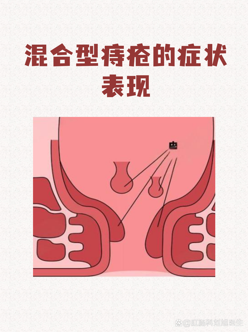 菊花肿了一瓣怎么回事?别慌,3个原因+对症修复方案 菊花肿了一瓣怎么回事?别慌,3个原因+对症修复方案