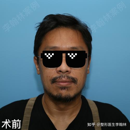 怎么种植胡子(胡须子)——从选时到成活的完整操作指南 一、适宜时间