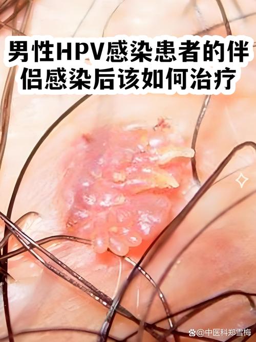 季节（治疗时机与周期）——影响治疗总成本