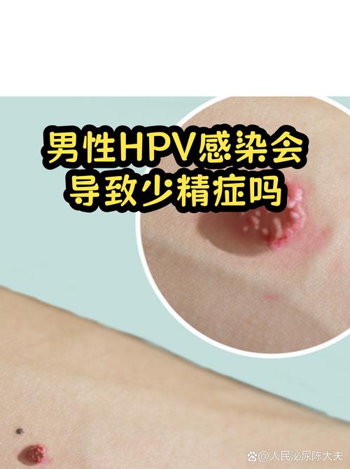 运输（物流与隐性成本）——不可忽视的费用