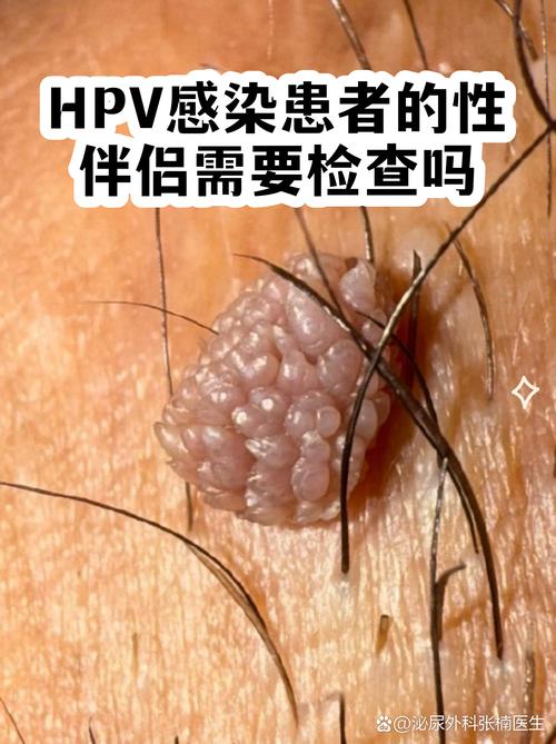 费用影响因素总览表