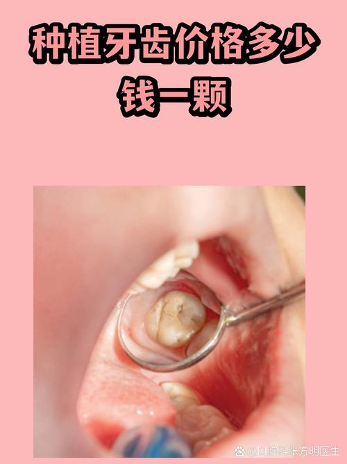综合对比表格：长春单颗种植牙各因素场景价格