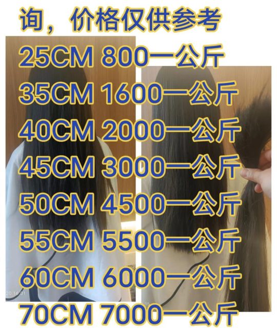 毛发种植价格