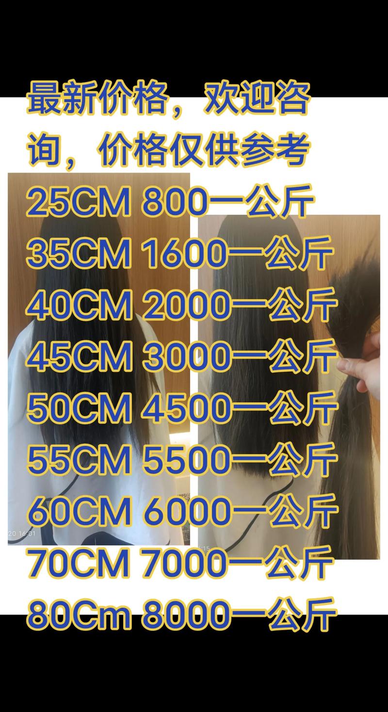 毛发种植价格 价格快速参考