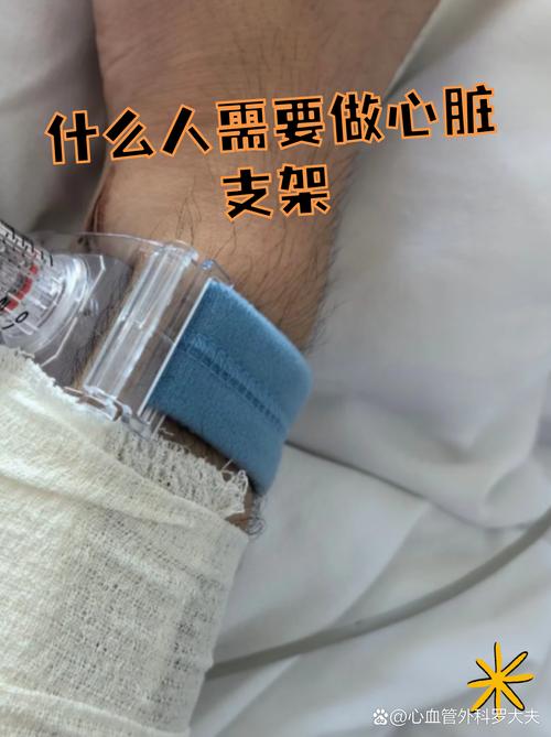 有心脏支架能种牙吗?答案不是简单的“能”或“不能” 四、种牙前要做哪些检查?
