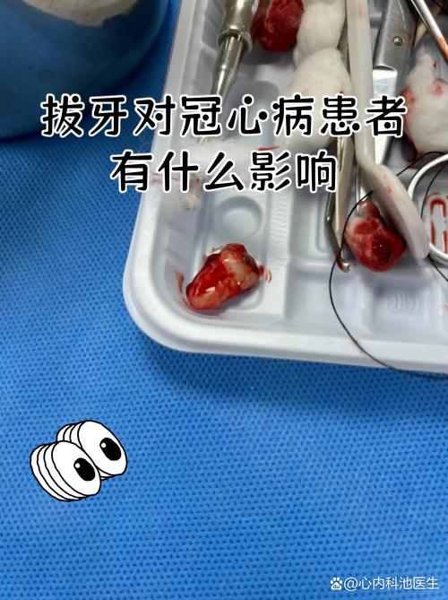 有心脏支架能种牙吗?答案不是简单的“能”或“不能” 七、哪些人更适合先做其他修复方式?