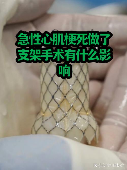 有心脏支架能种牙吗?答案不是简单的“能”或“不能” 九、最后给一句明确答案