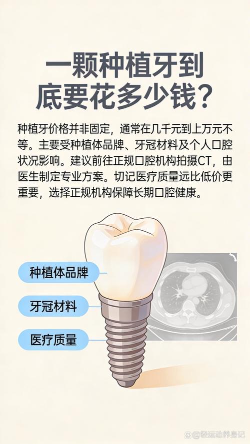 影响因素四：种植颗数与修复方案（数量）