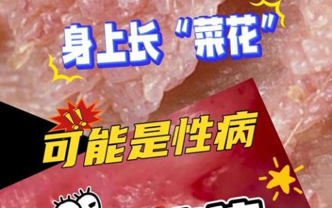 园艺植物“菜花状”病变：是恶性病害还是良性现象？