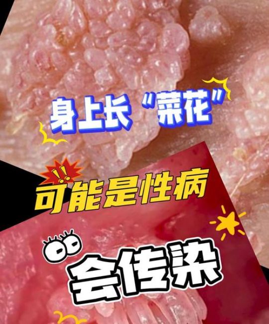 园艺植物“菜花状”病变：是恶性病害还是良性现象？